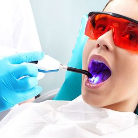 Clínica Dental Gonzalo Ayllon Gallardo adolescente en ortodoncia